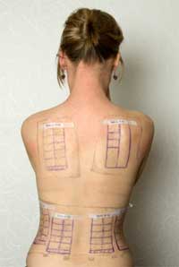 Patchtest