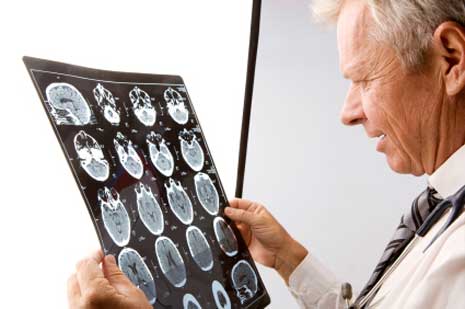 Doctor examining brain Scan