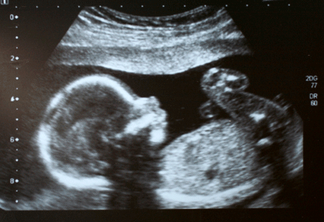 Flame retardants can cause neurodevelopmental problems for a baby